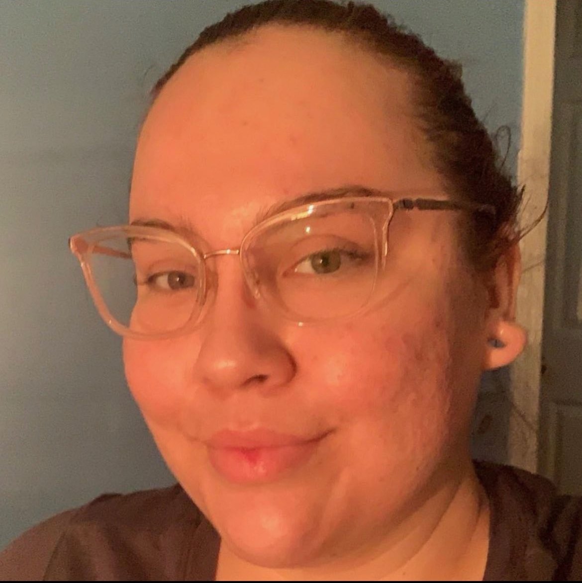 Clear skin after